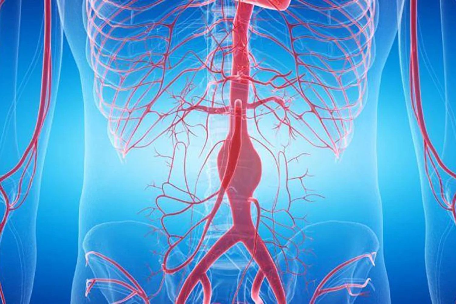 Condena porque retrasar ocho años el abordaje del aneurisma determinó la muerte