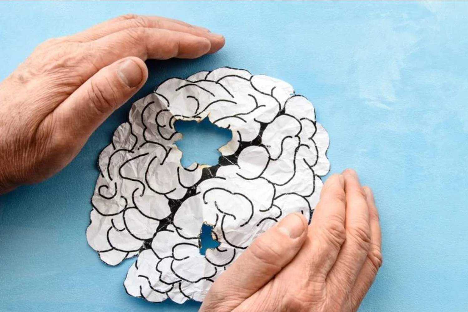 Delirio poscirugía, el factor predictor más sólido de deterioro cognitivo a largo plazo