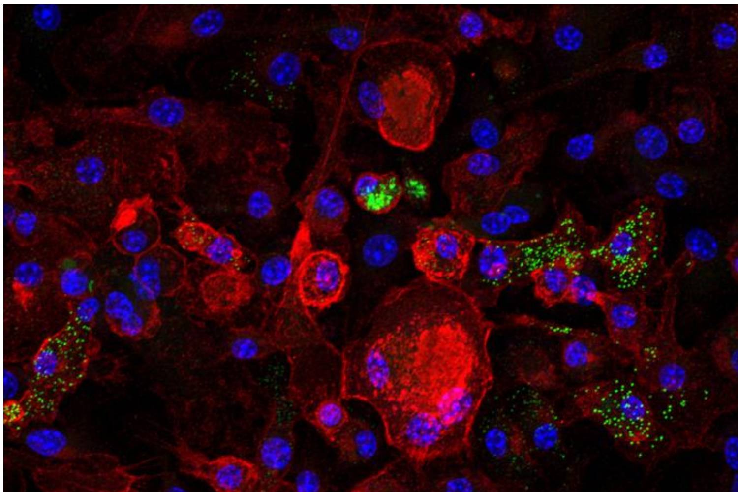 Identifican células ‘zombi’ que resucitan inflamación, envejecimiento e hígado graso