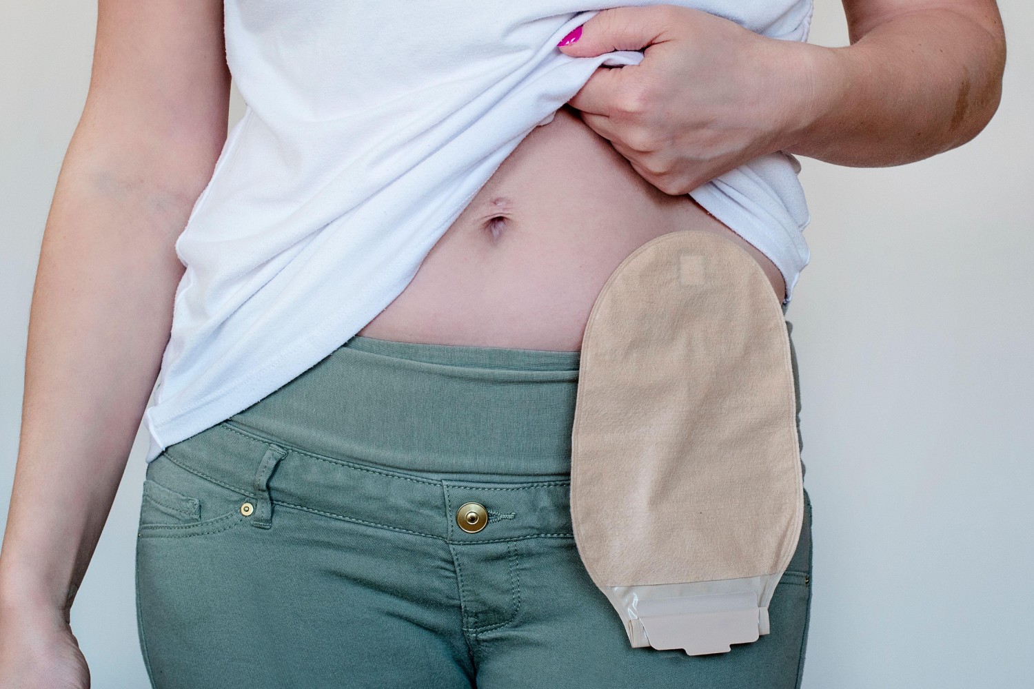 Más allá de la genética: el ‘ecosistema’ que favorece el aumento del cáncer en jóvenes